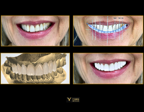 Website Products (84)